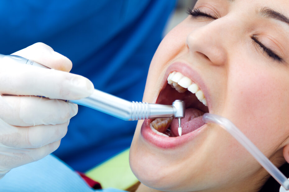 Teeth cleaning | Elite Smile Family Dentistry