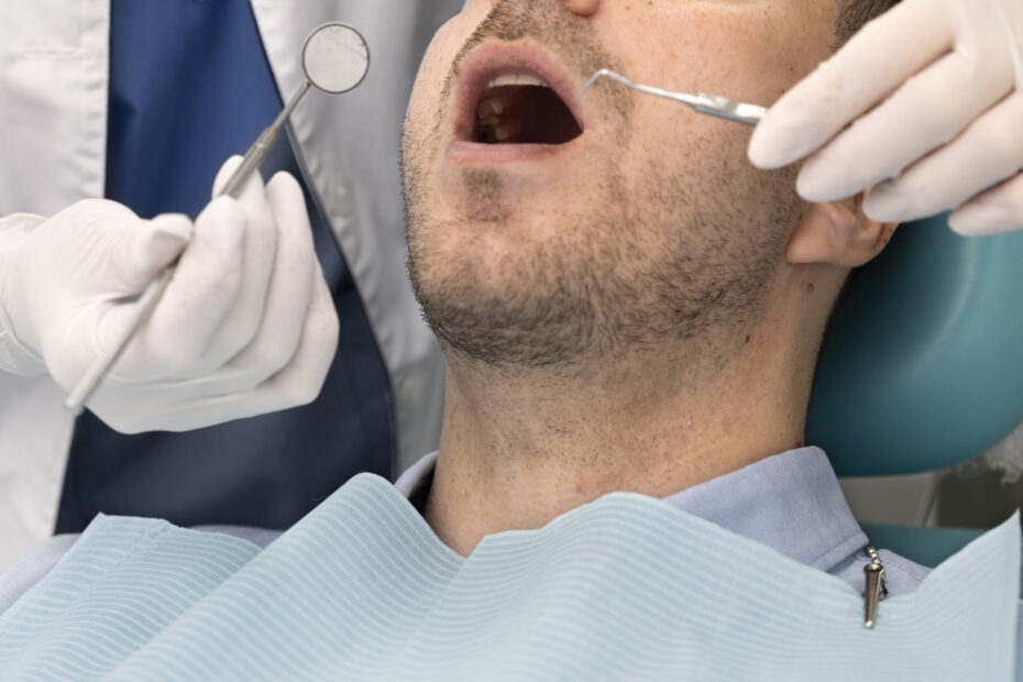 Tooth extraction | Elite smile Family Dentistry