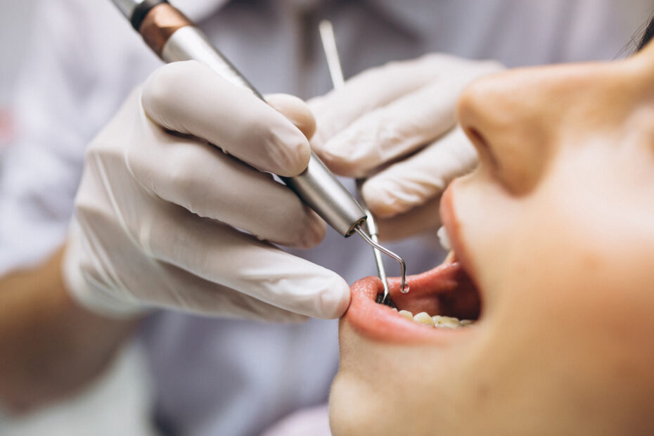 dental cleaning