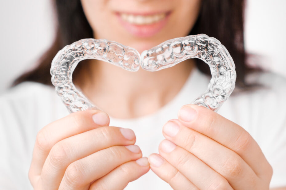 clear aligners