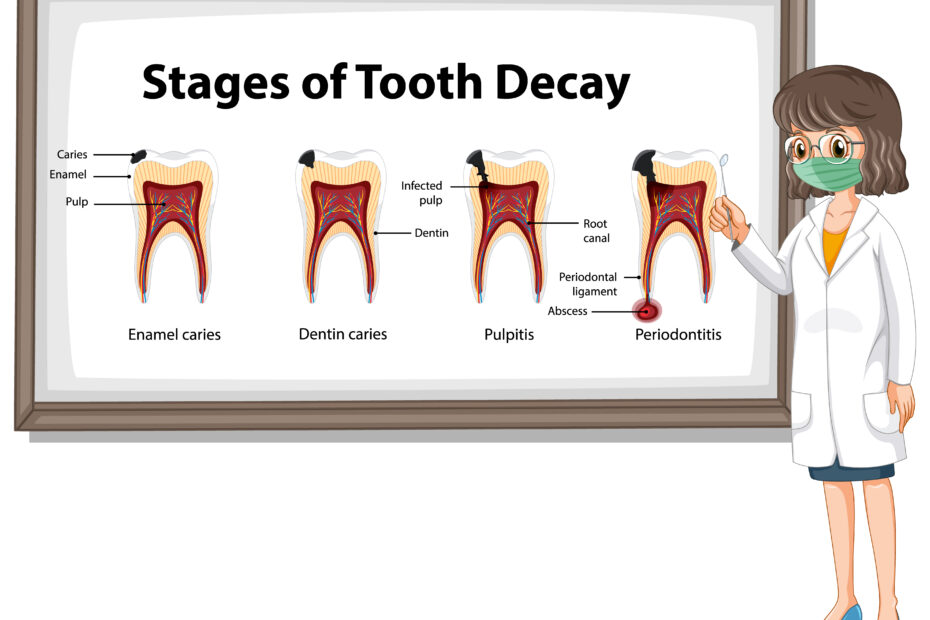 Root canal treatment