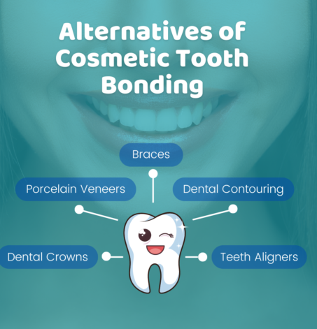 Cosmetic tooth bonding | Elite Smile Family Dentistry