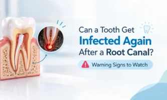 Can a Tooth Get Infected Again After a Root Canal