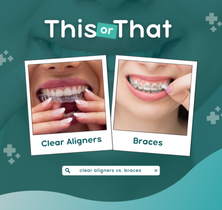 Clear aligners | Elite Smile Family Dentistry