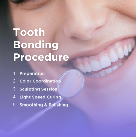 Cosmetic tooth bonding | Elite Smile Family Dentistry