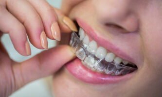 Invisalign Provider | Elite Smile Family Dentistry