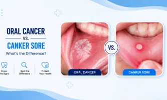 Oral cancer and canker sore