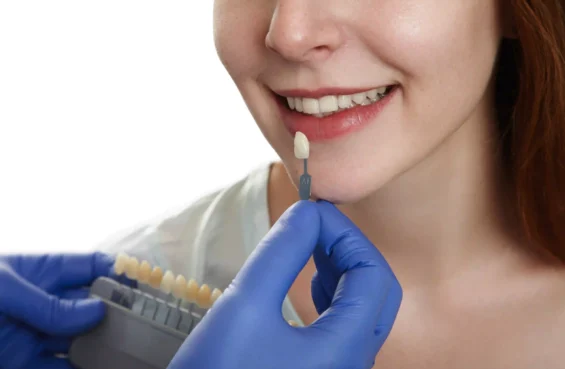 Porcelain Veneers