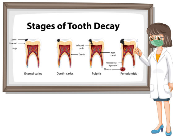 Root canal treatment