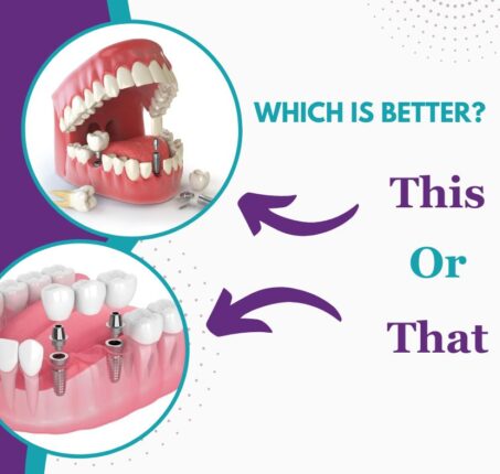 Implant dentistry or Bridges | Elite Smile Family Dentistry