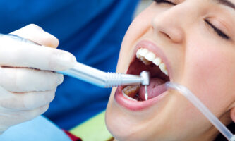 Teeth cleaning | Elite Smile Family Dentistry
