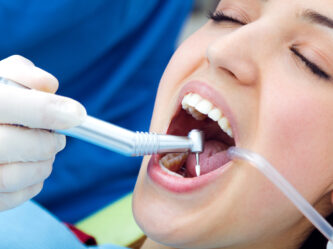 Teeth cleaning | Elite Smile Family Dentistry