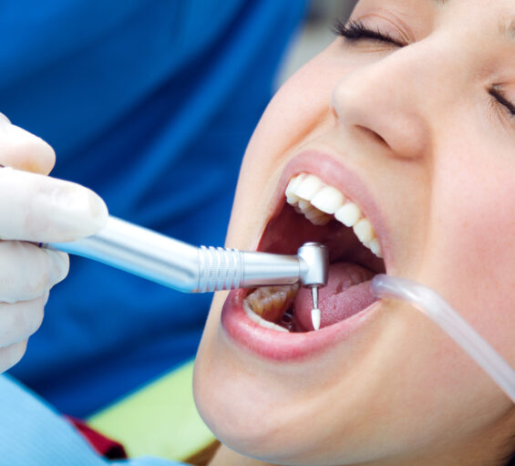 Teeth cleaning | Elite Smile Family Dentistry