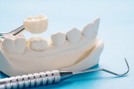 Crowns & Bridges | Elite Smile Family Dentistry