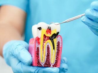 Root Canal Treatment | Elite Smile Family dentistry