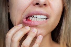 Gum disease treatment | Elite Smile Family Dentistry
