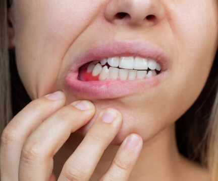 Gum disease treatment | Elite Smile Family Dentistry