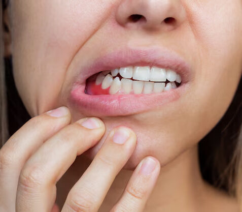 Gum disease treatment | Elite Smile Family Dentistry