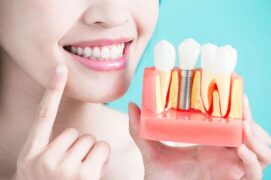 Implant dentistry | Elite Smile Family Dentistry
