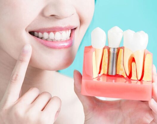 Implant dentistry | Elite Smile Family Dentistry