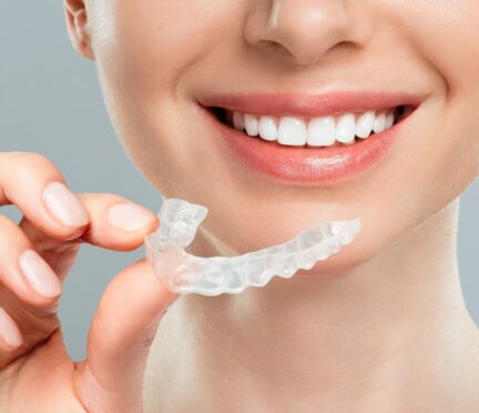 Invisalign | Elite Smile Family Dentistry