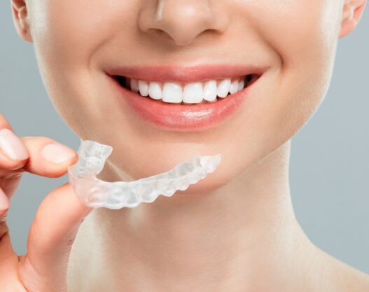 Invisalign | Elite Smile Family Dentistry