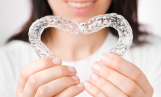 Clear Aligners