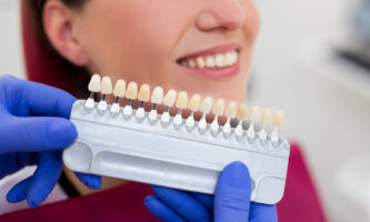 Porcelain veneers | Elite Smile family dentistry