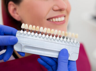 Porcelain veneers | Elite Smile family dentistry