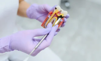 Root canal treatment