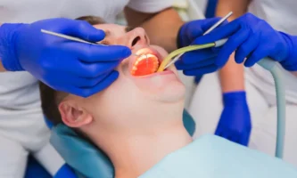 Tooth Extraction