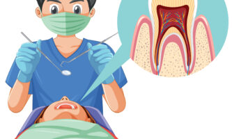 Root canal treatment